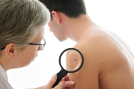 Dermatologist In Delhi, best Dermatologist In Delhi