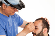 Hair Transplant in Delhi
