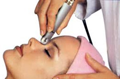 Microdermabrasion